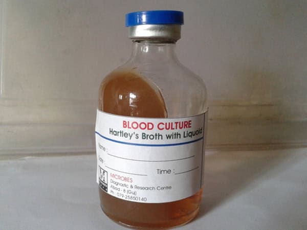 BI-Phasic-Blood-Culture-Media