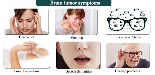 Brain-tumor-symptoms