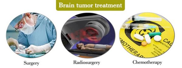 Brain-tumor-treatment-min