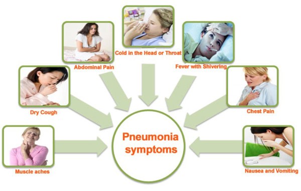 Treatment of Pneumonia 1