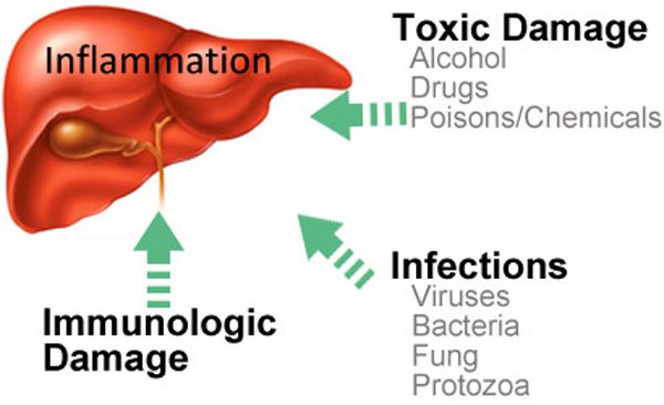 cause_liver_cancer