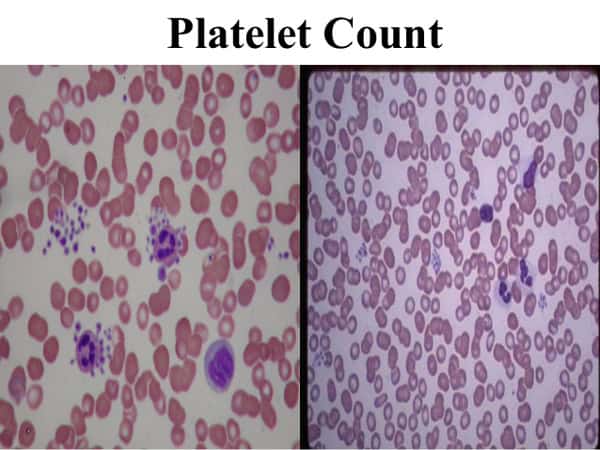 platelet count