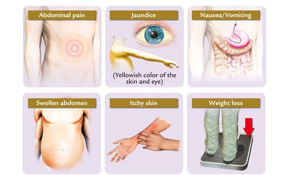 symptoms