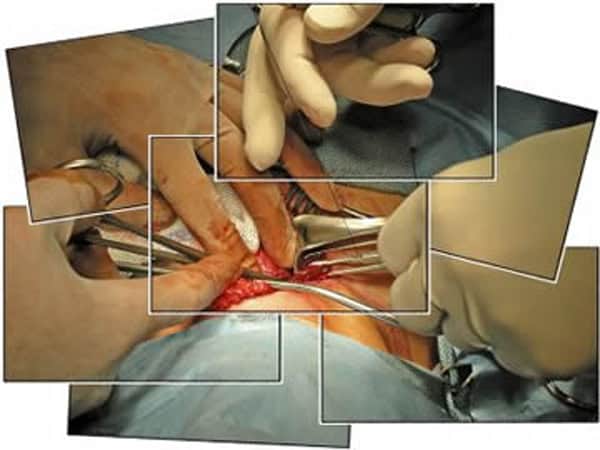 tr thyroid-cancer