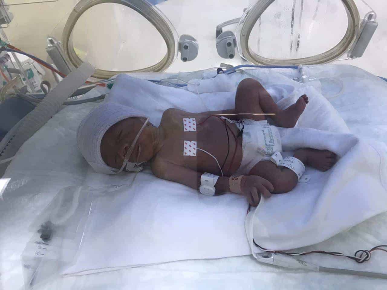 Premature delivery costing Rs. 4.5 crore to TS family in Riyadh