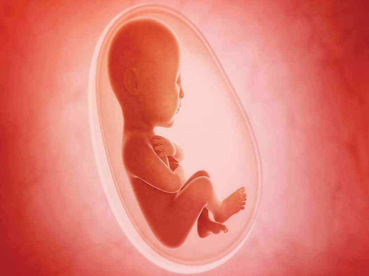 Abortion