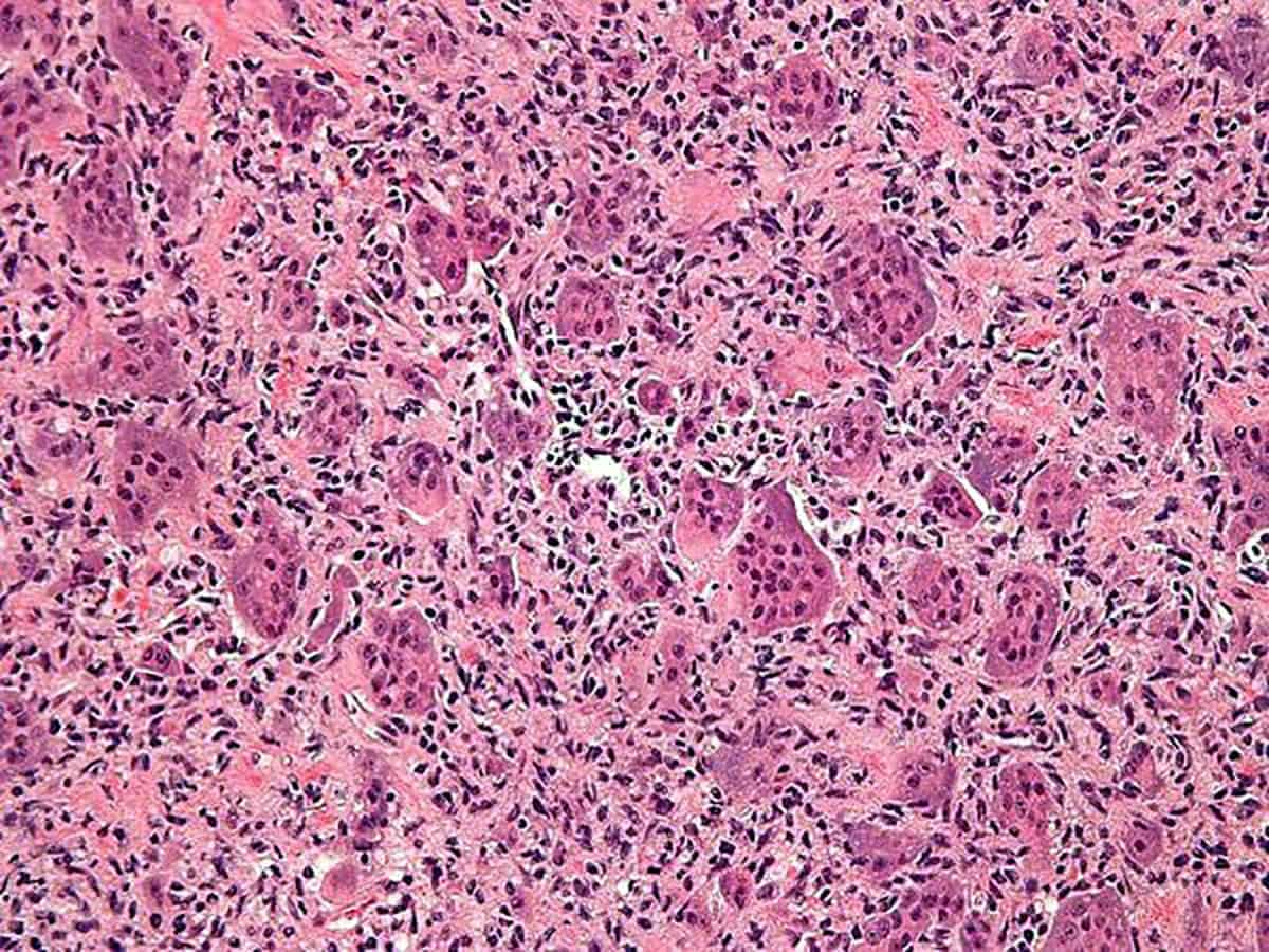 Cells fight stress with adhesion: Study