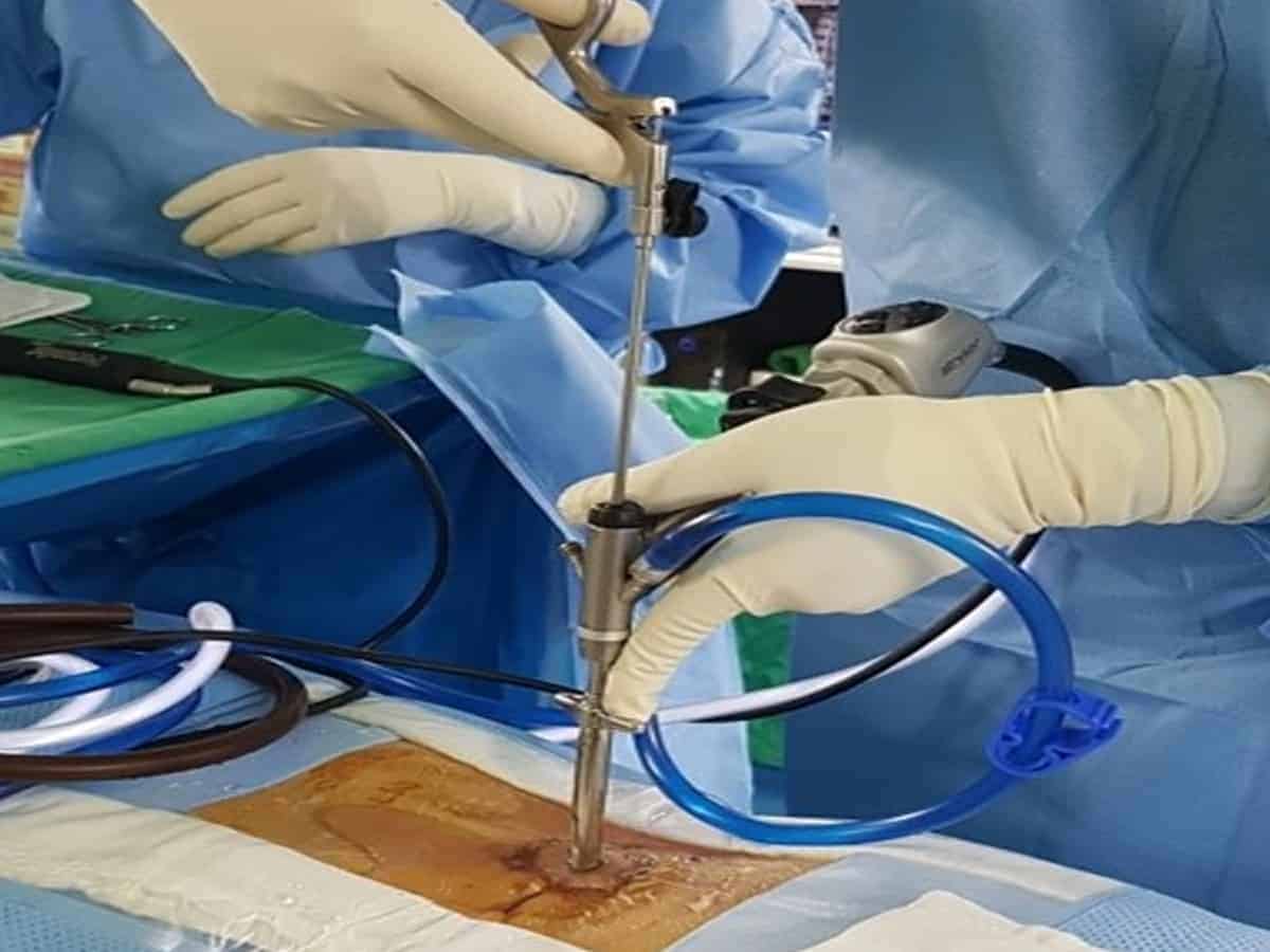 Surgery