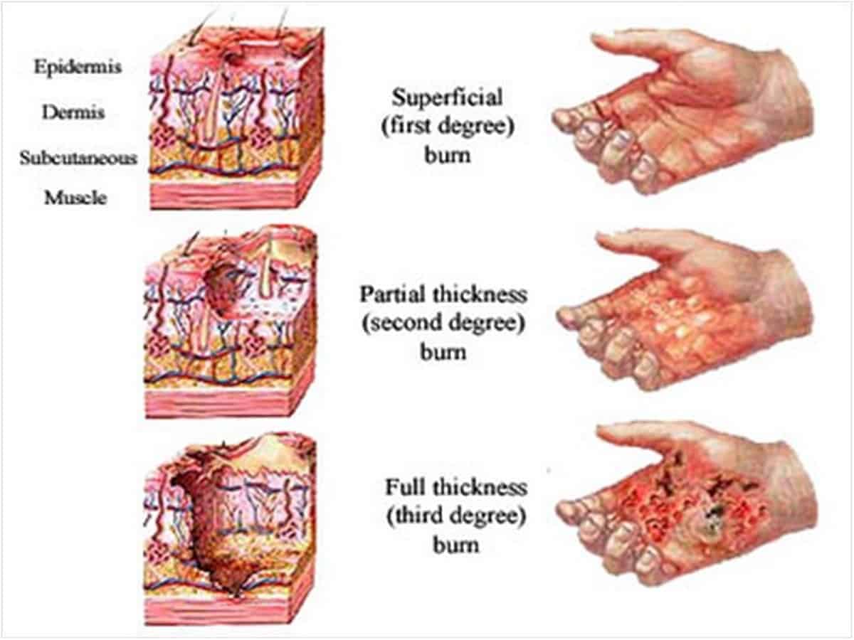 skin cells