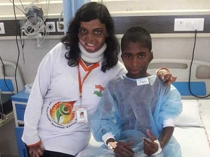 New ray of light for burn survivors