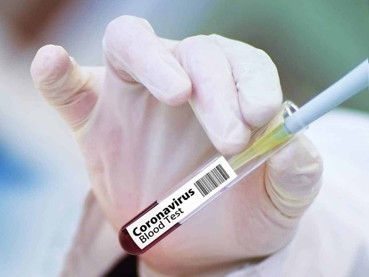 Coronavirus cases in Saudi Arabia