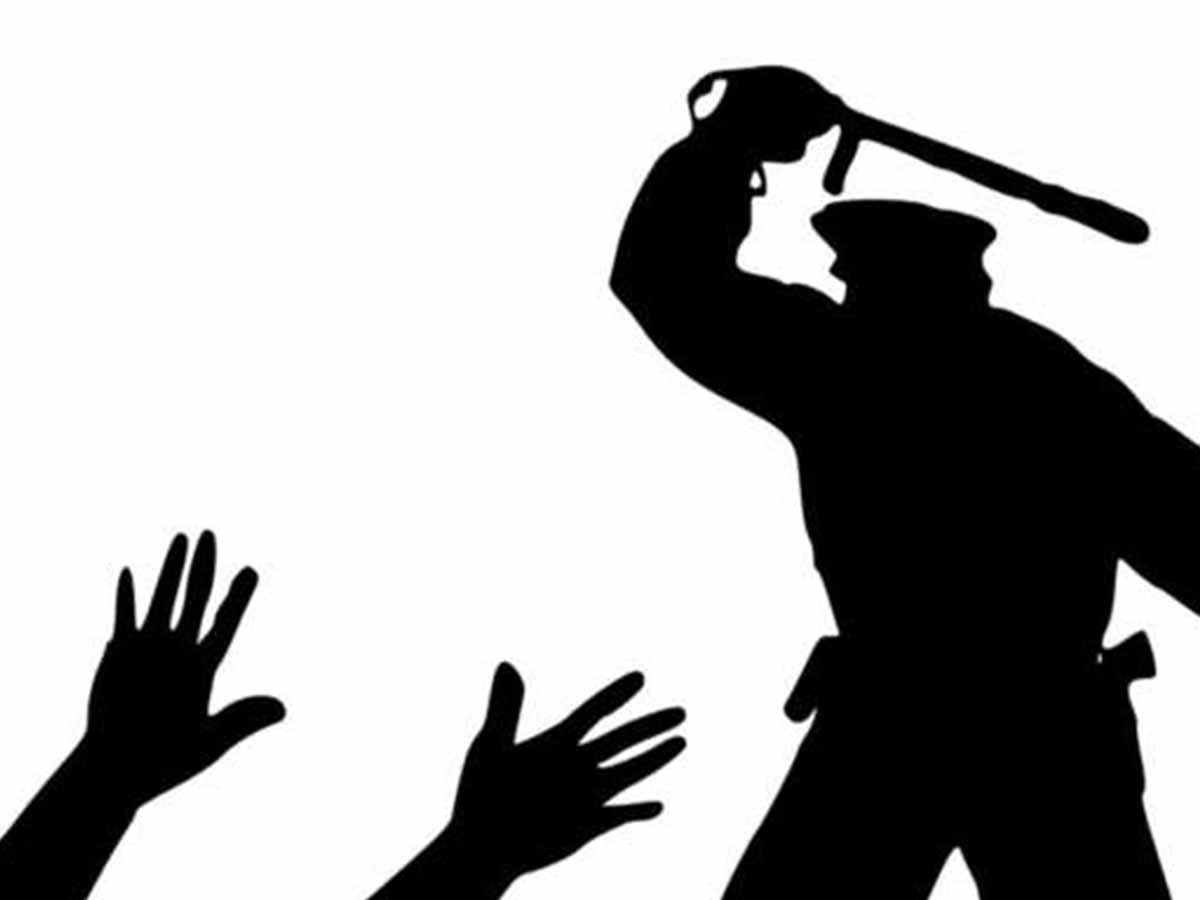 BJP condemns police action against party workers