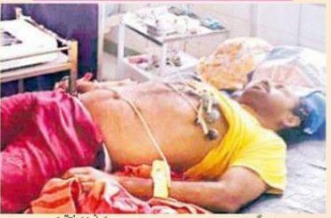 dead body of covid victim