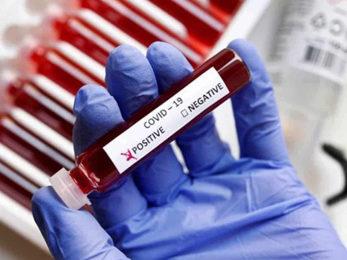 Medical superintendent of district tests COVID-19 positive in UP