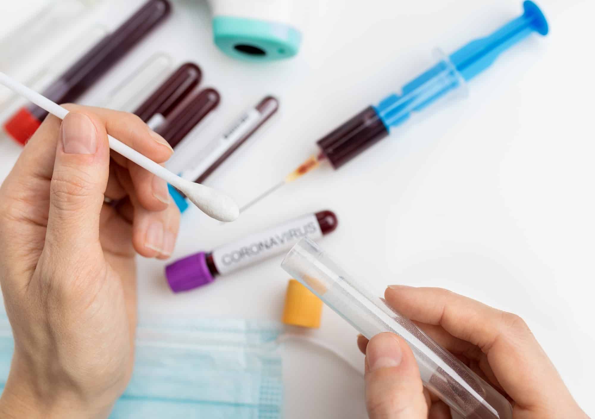 Laboratory sample of the novel Coronavirus