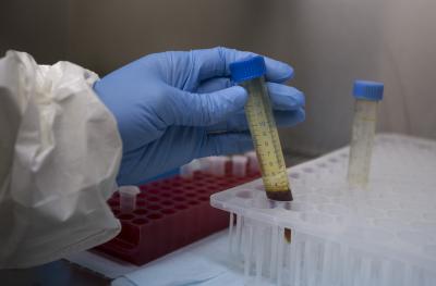 Dedicated clinics can reduce impact of flu pandemic: Study