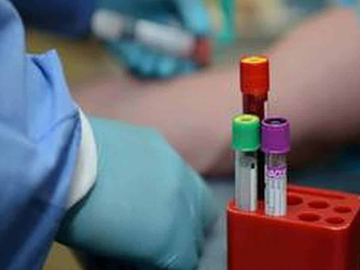 Maharashtra Police reports 247 new COVID-19 cases