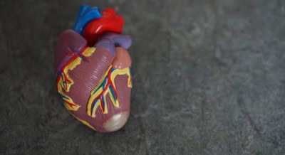 Common diabetes drug linked to low risk of major heart issues