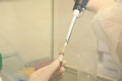 Covid-19 can cause decline in life expectancy globally: Study