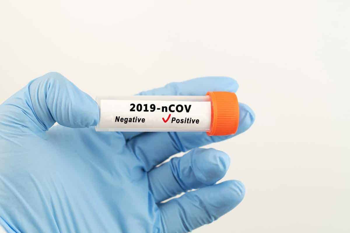 Coronavirus testing