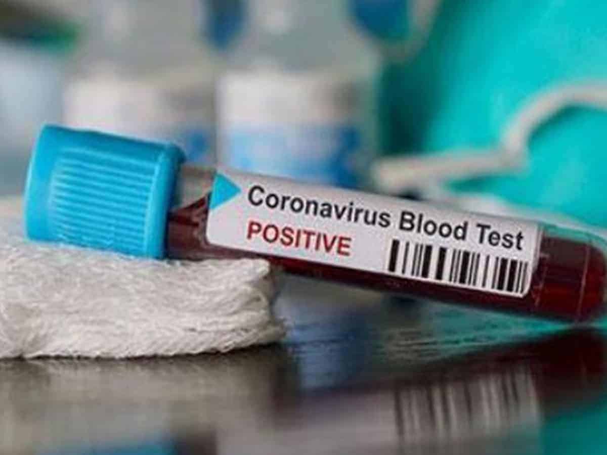 Telangana reports 1,891 new COVID-19 cases, 7 deaths