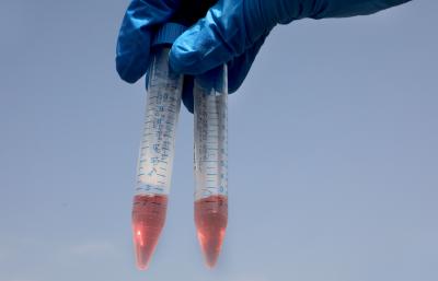 Syngene joins global consortium on Covid-19 testing research