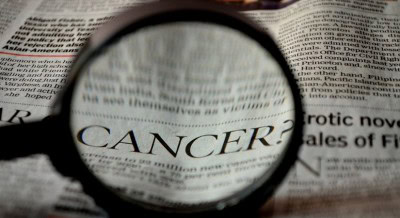 AI-based technique may detect prostate cancer from urine