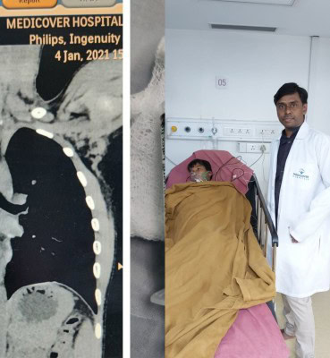 Doctors remove toy bulb from 9-year-old's lungs