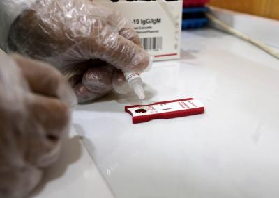 Rapid blood test to detect severe disease risk of Covid patients