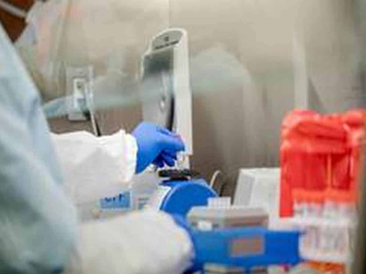 Turkey reports 39,302 new COVID-19 cases, 3,317,182 in total