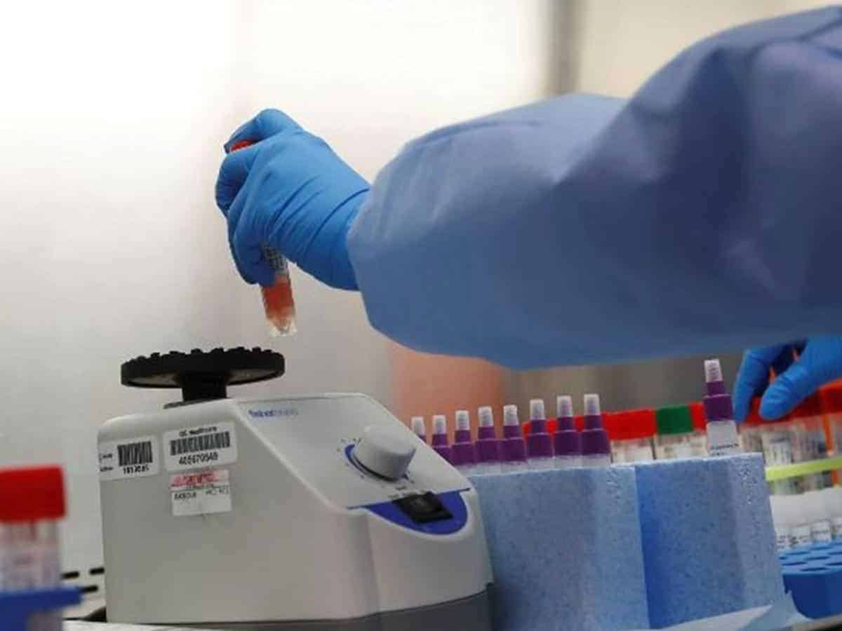 'Rare' genome proves Covid was made in Chinese lab: US experts