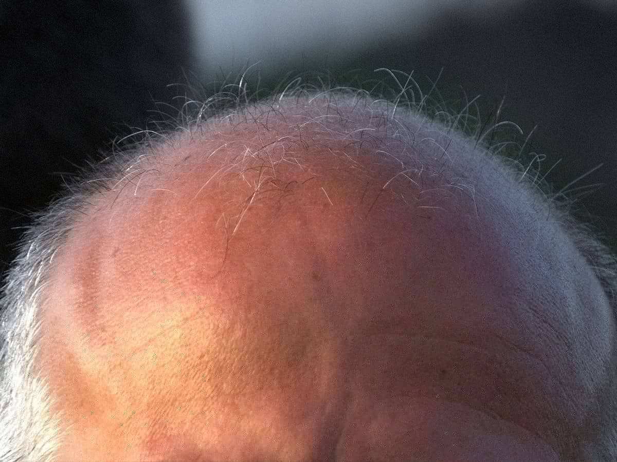 Saudi Arabia: Woman seeks divorce over husband’s baldness