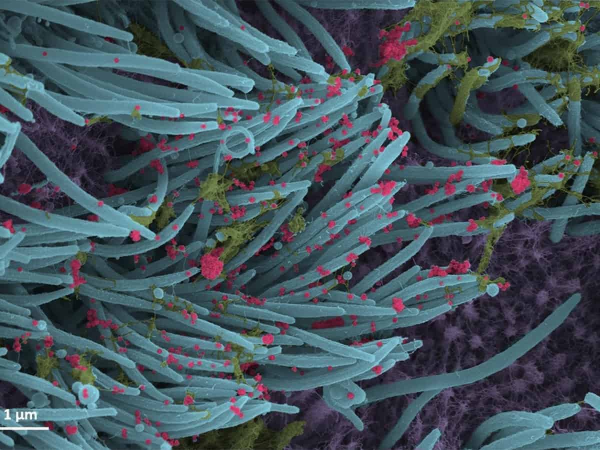 Delta-like SARS-CoV-2 variant may increase pandemic severity
