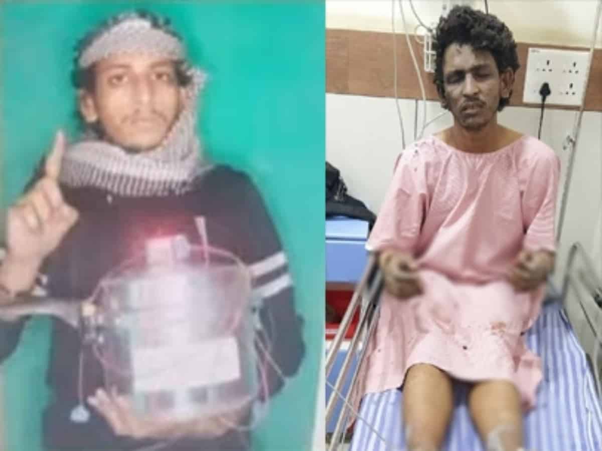 Mangaluru blast: NIA expedites probe as terror suspect recovers