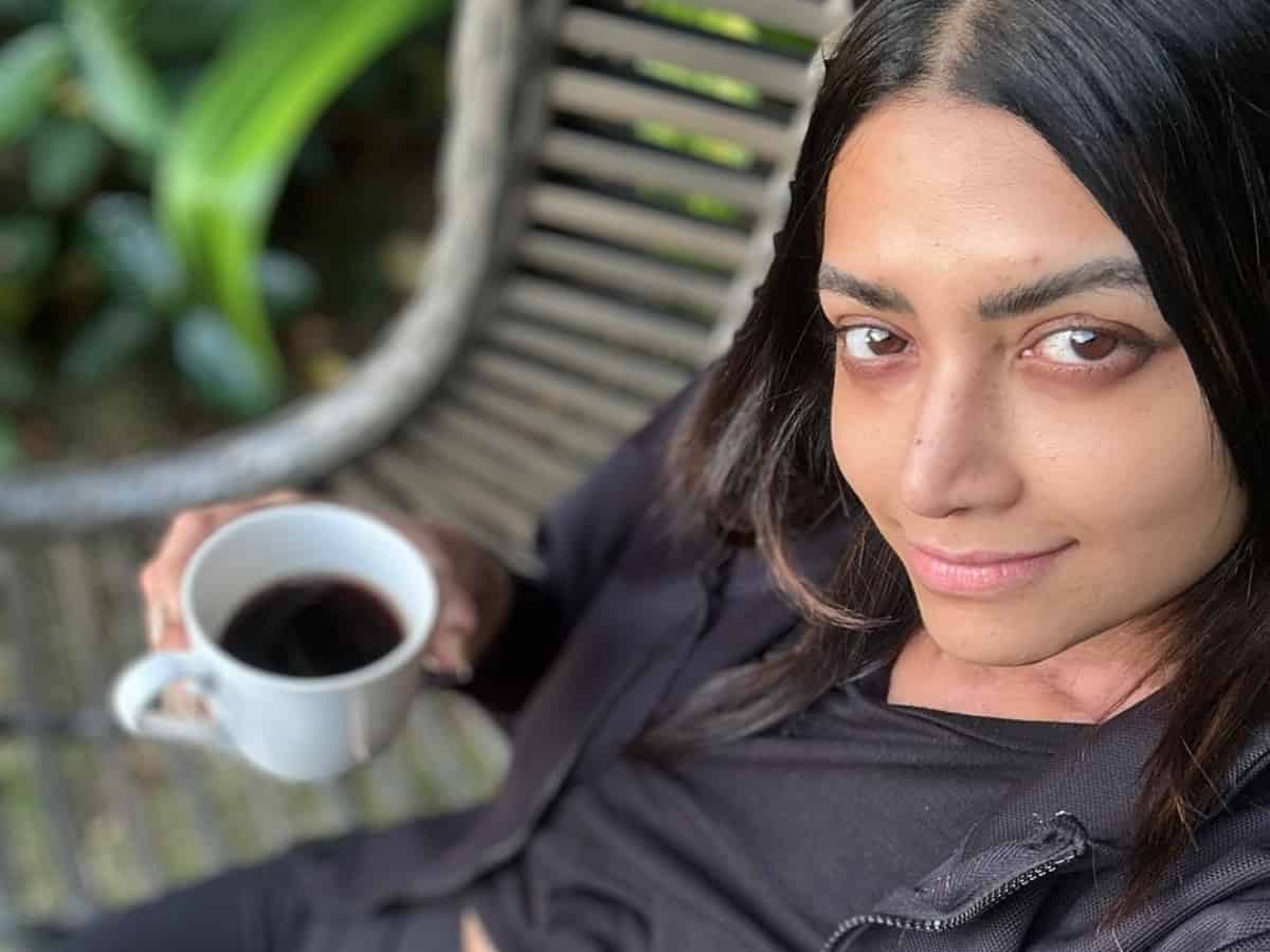 "I'm losing colour": Mamta Mohandas reveals being diagnosed with autoimmune disease vitiligo